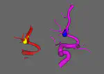 The aneurysm and vessel segmentation for 3D digital subtraction angiography images